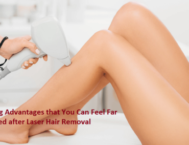 Laser Hair Removal Surat