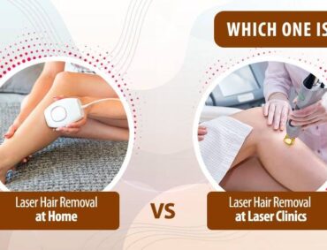 Laser Hair reduction Surat