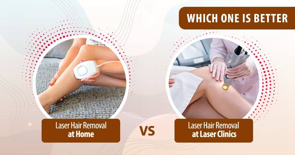 Laser Hair reduction Surat