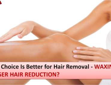Laser Hair Reduction Surat