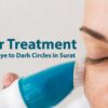 Laser Treatment Say Goodbye to Dark Circles in Surat