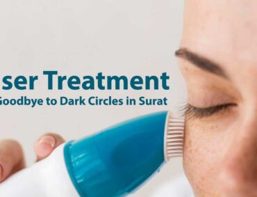 Laser Treatment Say Goodbye to Dark Circles in Surat