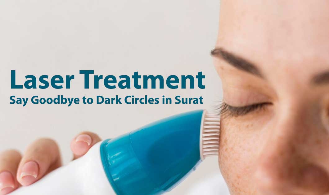 Laser Treatment Say Goodbye to Dark Circles in Surat