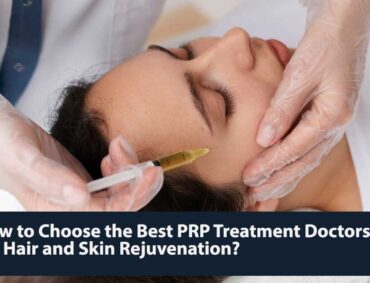 How to Choose the Best PRP Treatment Doctors for Hair and Skin Rejuvenation