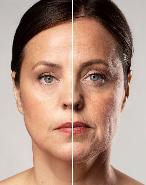 ServiceThumb_ANTI-AGEING
