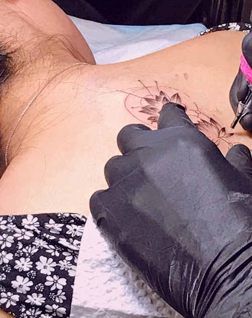ServiceThumb_TATTOO-REMOVAL