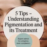 5 Tips Understanding Pigmentation and Its Treatment