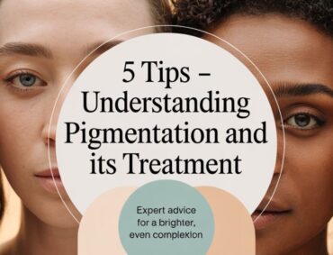 5 Tips Understanding Pigmentation and Its Treatment