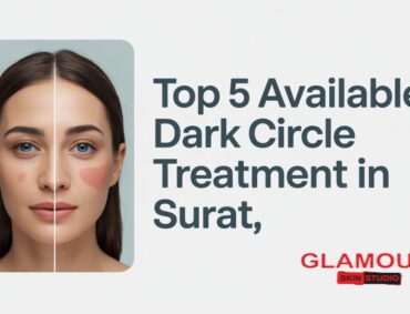 Top 5 Available Dark Circle Treatments in Surat