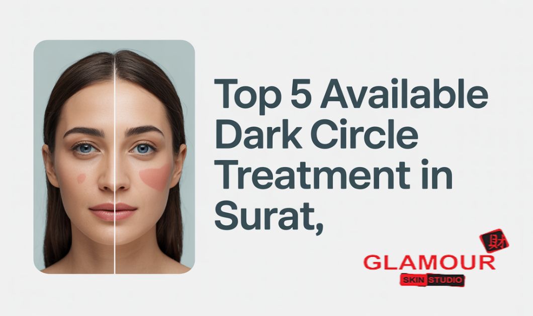 Top 5 Available Dark Circle Treatments in Surat