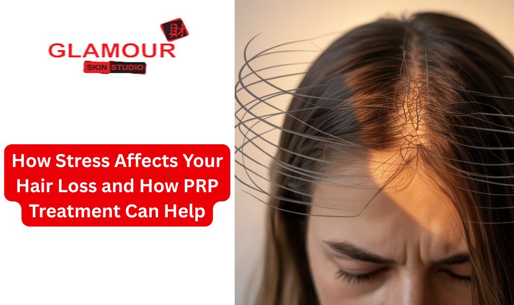 How Stress Affects Your Hair Loss and How PRP Treatment Can Help