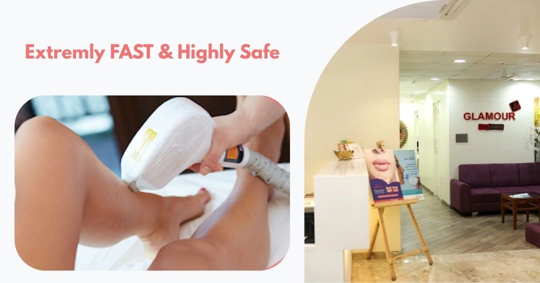 laser hair removal in Surat