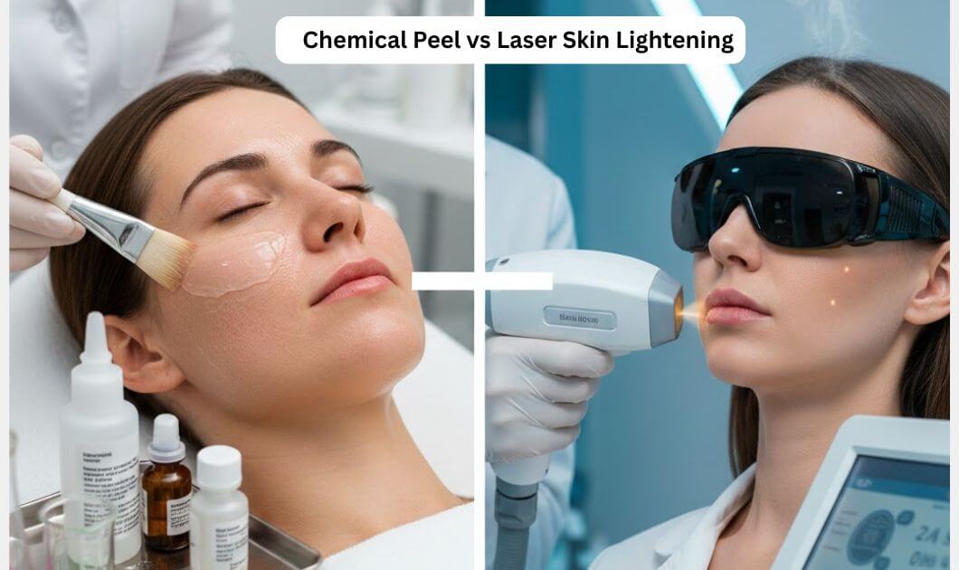 Chemical Peel vs Laser Skin Lightening